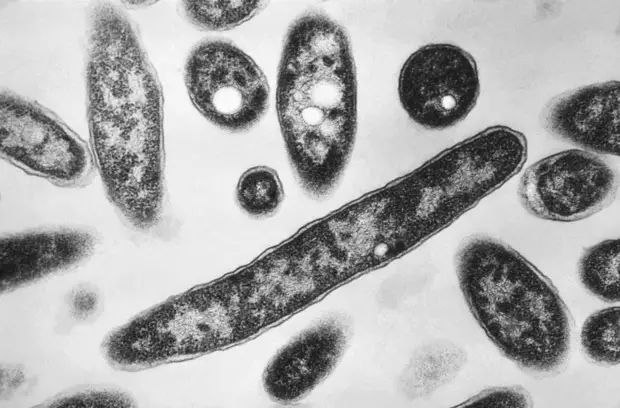 军团病致波兰16人死亡